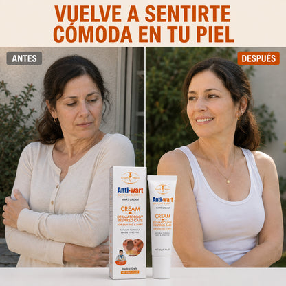 Trata las verrugas de forma simple y segura