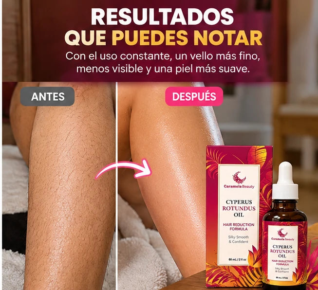 ¿Cansada de depilarte tan seguido?
